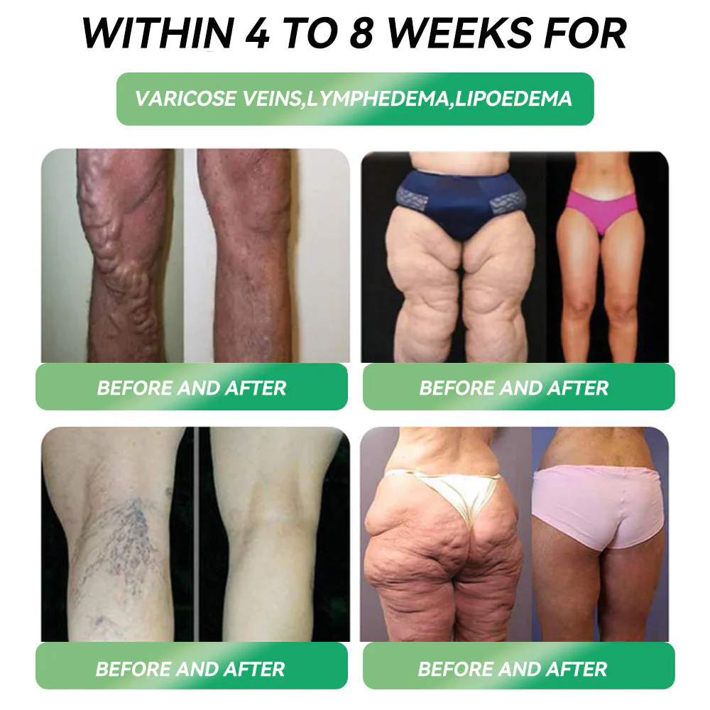 [Effective in 7 days]𝐀𝐀𝑭𝐐®👩‍⚕️ 𝐆𝑳𝐏-𝟏 𝑊𝑒𝑖𝑔ℎ𝑡 𝐿𝑜𝑠𝑠 𝑂𝑟𝑎𝑙 𝑆𝑜𝑙𝑢𝑡𝑖𝑜𝑛   𝑂𝑏𝑒𝑠𝑖𝑡𝑦,𝐶𝑎𝑟𝑑𝑖𝑜𝑣𝑎𝑠𝑐𝑢𝑙𝑎𝑟 𝐷𝑖𝑠𝑒𝑎𝑠, 𝐷𝑖𝑎𝑏𝑒𝑡𝑒𝑠, 𝑆𝑙𝑒𝑒𝑝 𝐴𝑝𝑛𝑒𝑎, 𝐽𝑜𝑖𝑛𝑡 𝑃𝑟𝑜𝑏𝑙𝑒𝑚𝑠 𝑎𝑛𝑑 𝑀𝑜𝑟𝑒📊 | 𝑂𝑓𝑓𝑖𝑐𝑖𝑎𝑙 𝑆𝑡𝑜𝑟𝑒 |🏆